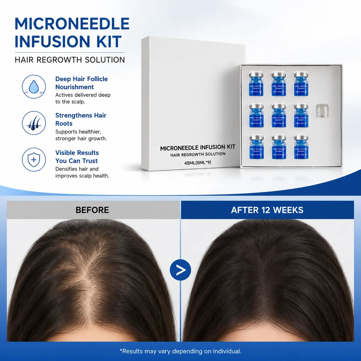 Kit de microagujas para el crecimiento del cabello