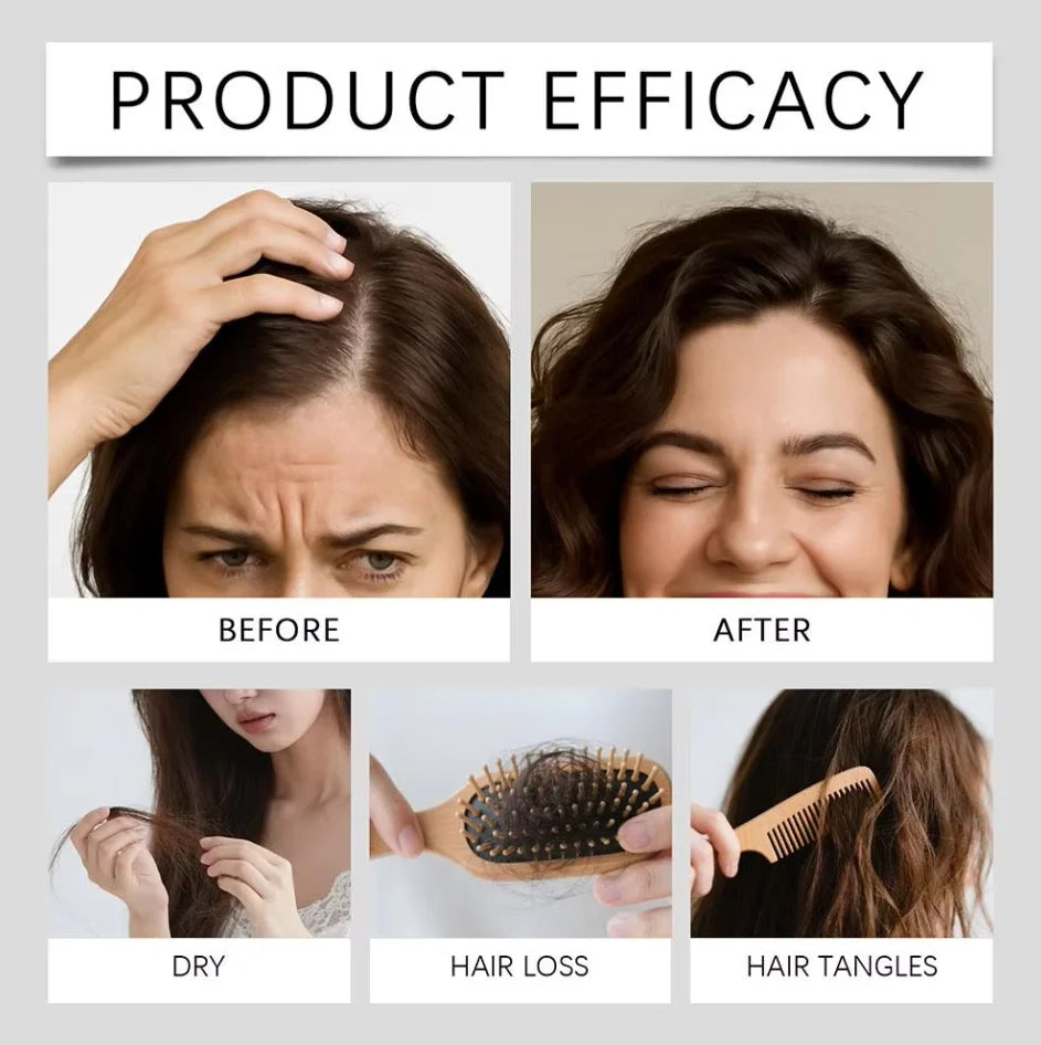 Kit de microagujas para el crecimiento del cabello